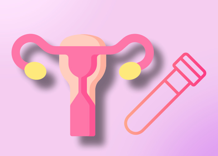 난소-혈액샘플-그림