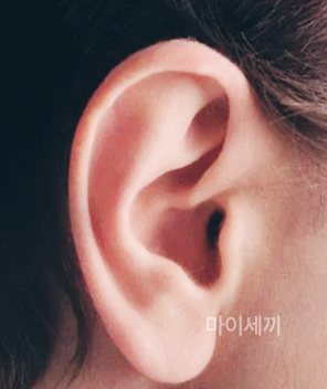 외이도염 증상 이명 원인 치료 외이도염 자연치유 