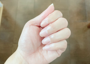 손톱의 검은 선