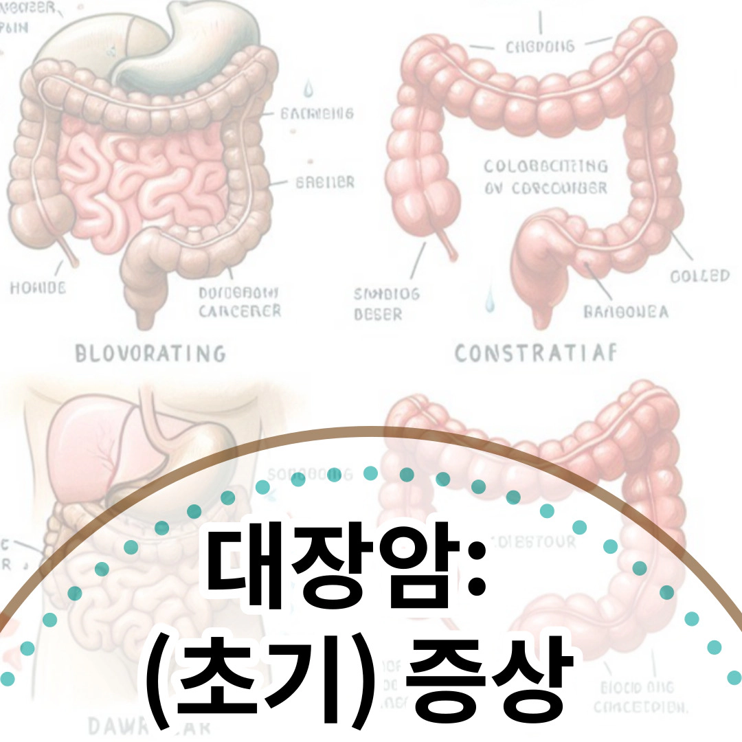 대장암: 초기 증상과 증상