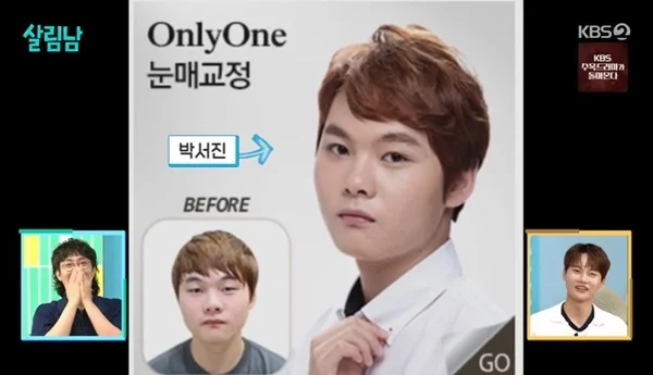 박서진 성형 변천사
