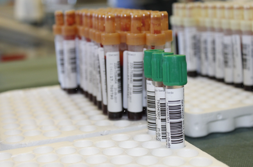 왜? 꼭! 샤워할 때 이 부분을 씻어야 하는가? 생명까지 위협하는 패혈증까지 유발