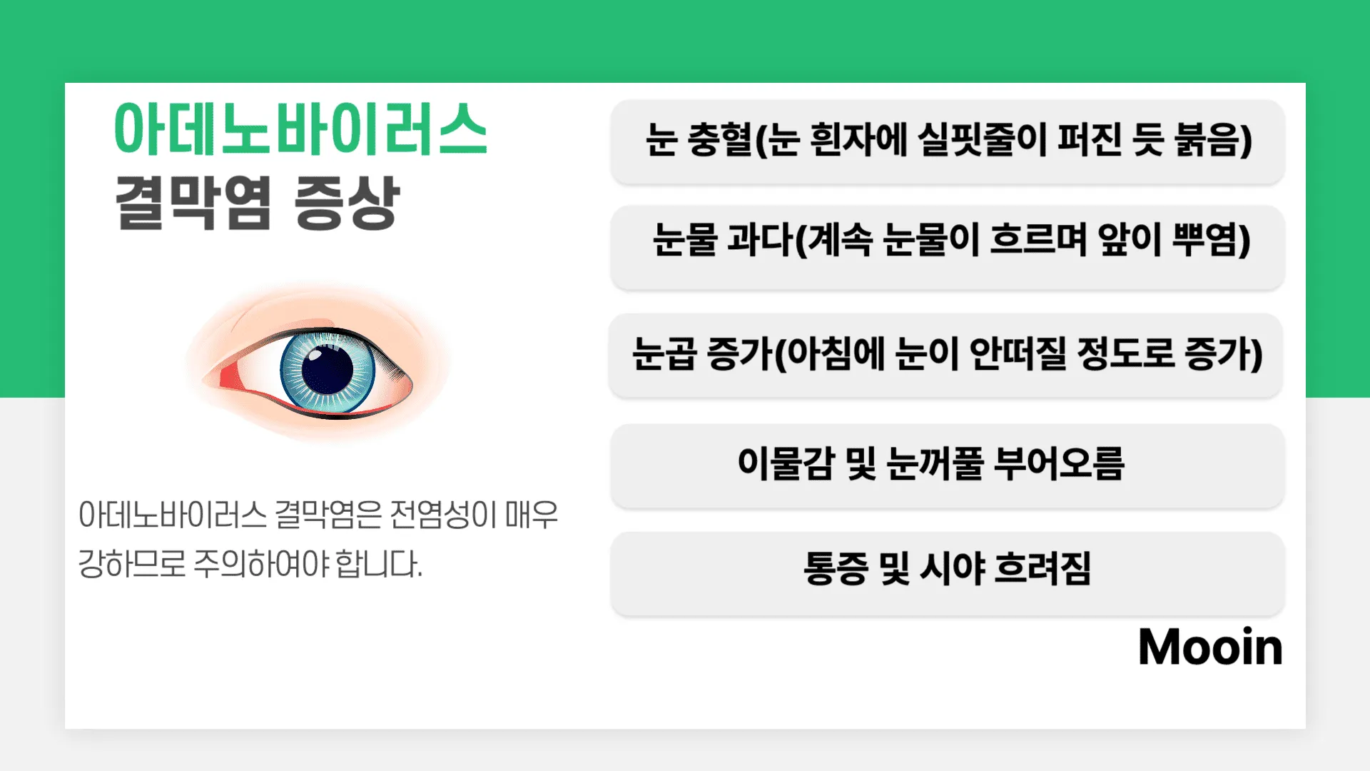 아데노바이러스 결막염 증상