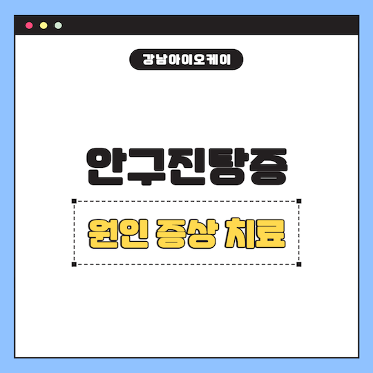 안구진탕증-원인-증상-치료