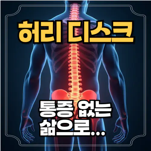 허리디스크