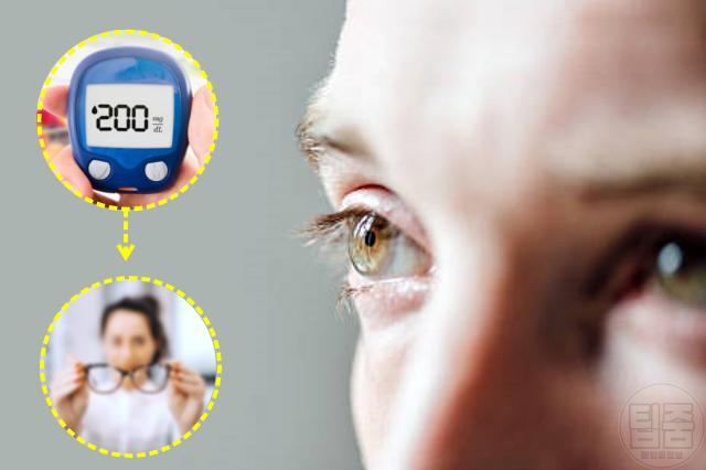혈당이 높으면 나타나는 증상 시력저하 흐림