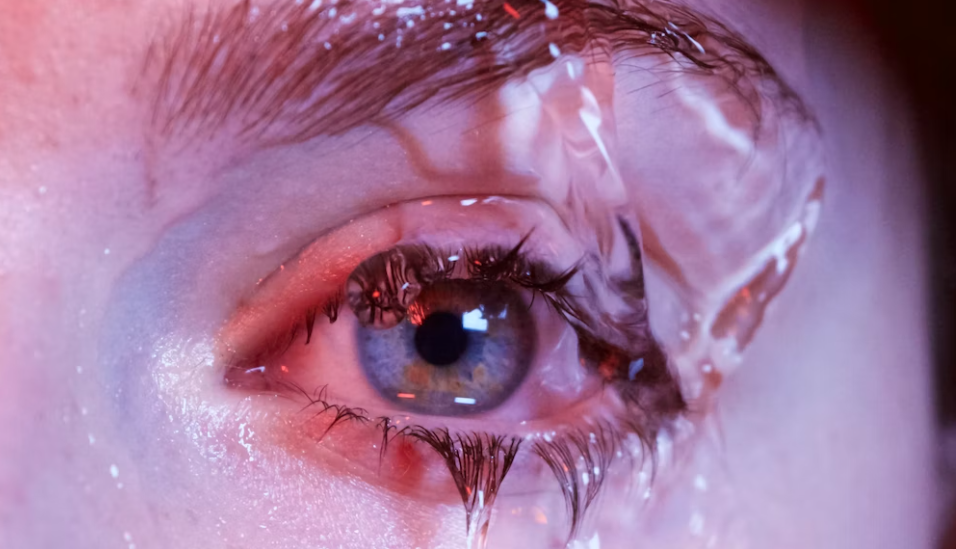 안구건조증 치료방법