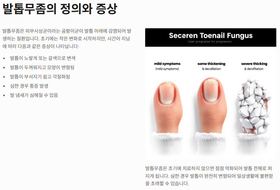 발톱무좀 원인과 제거하는 꿀팁 총정리 (2025ver)