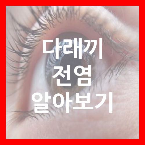 다래끼 전염 알아보기