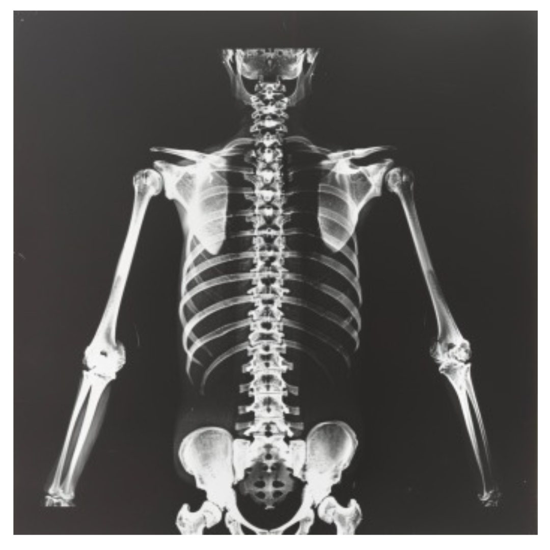 어깨통증과 관련된 사진입니다.