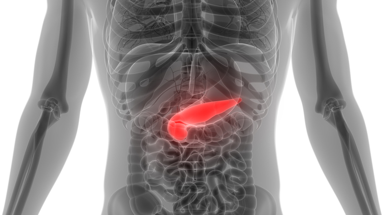 췌장암 초기 증상