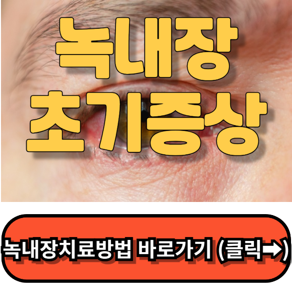 녹내장초기증상,녹내장증상, 녹내장