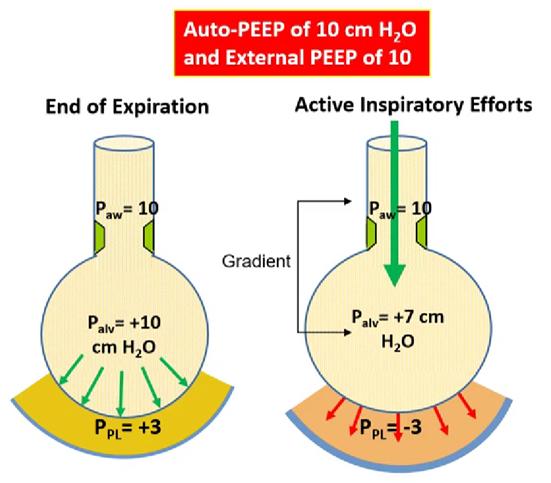 inspiratory pressure gradient with autoPEEP