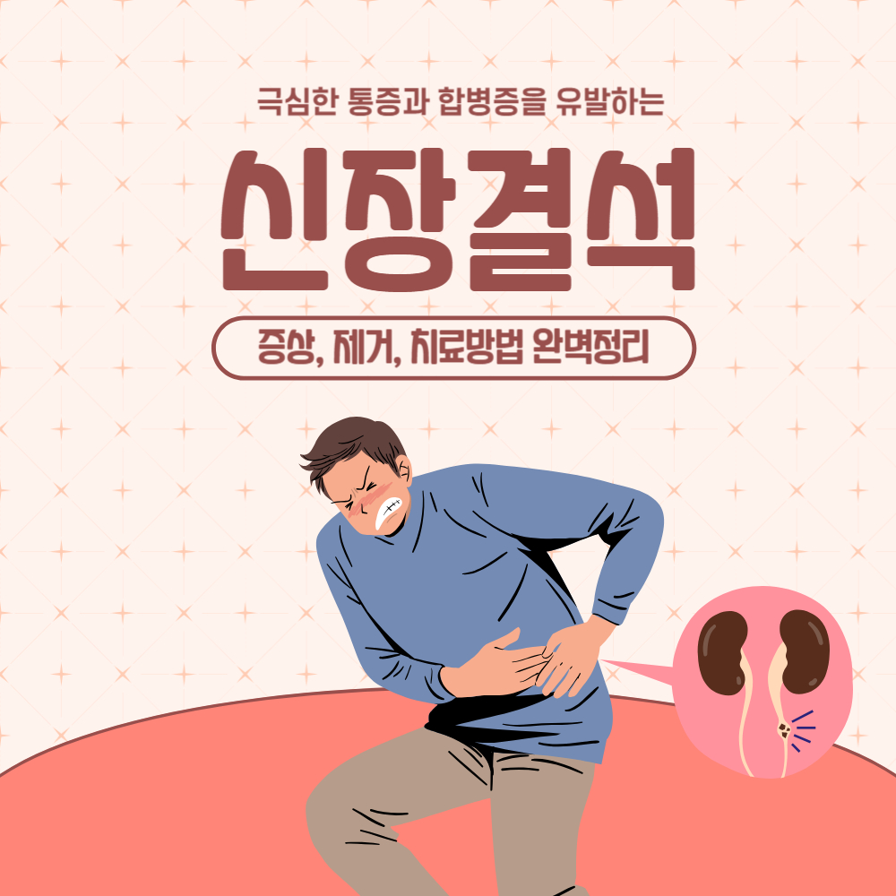 신장 결석 증상과 치료방법 완벽정리