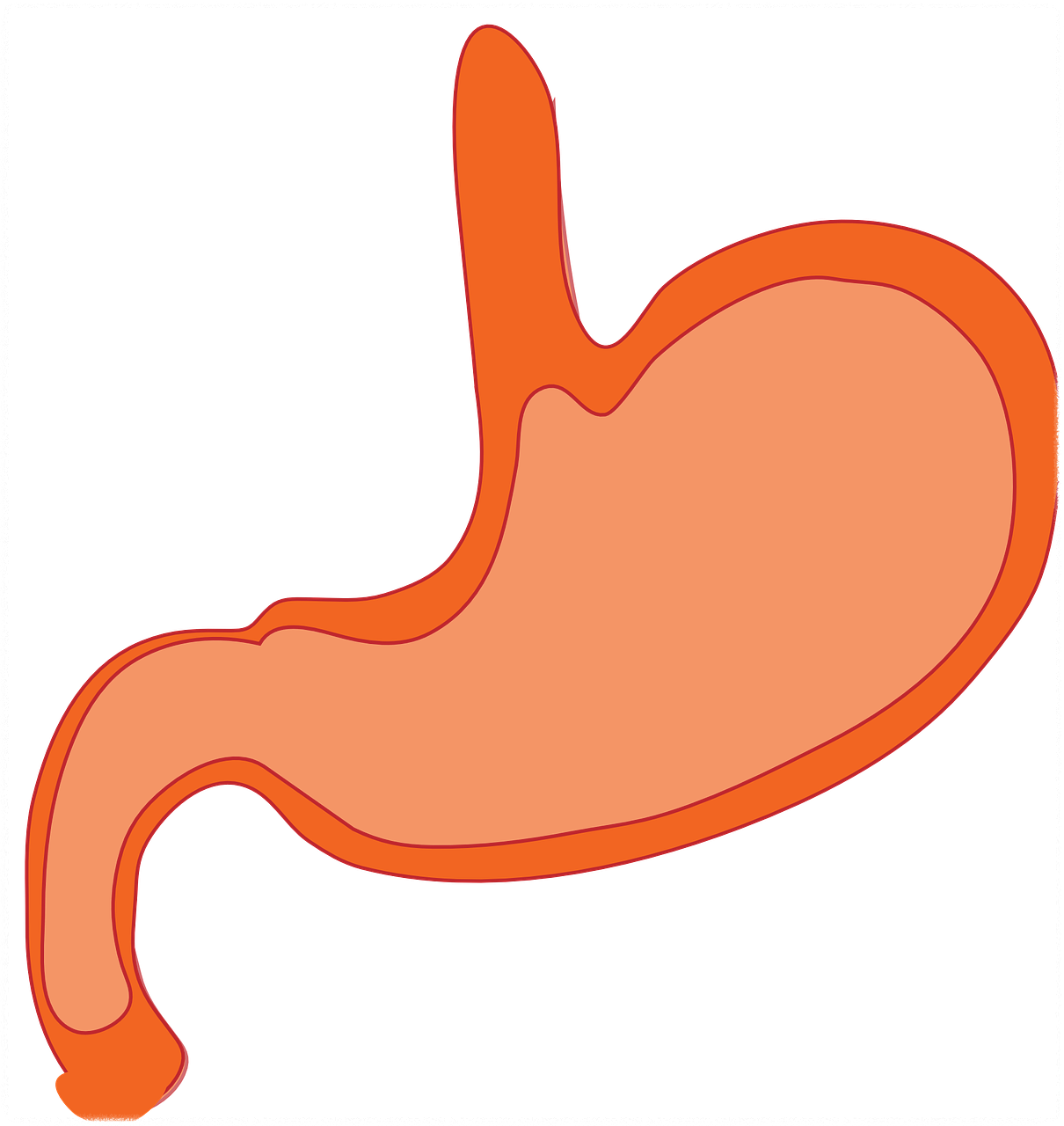 조직검사가 필요한 경우 안내3