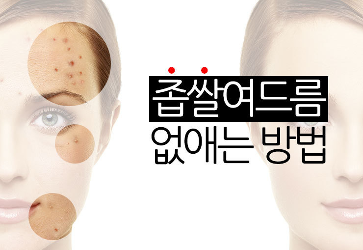 좁쌀 여드름 없애기