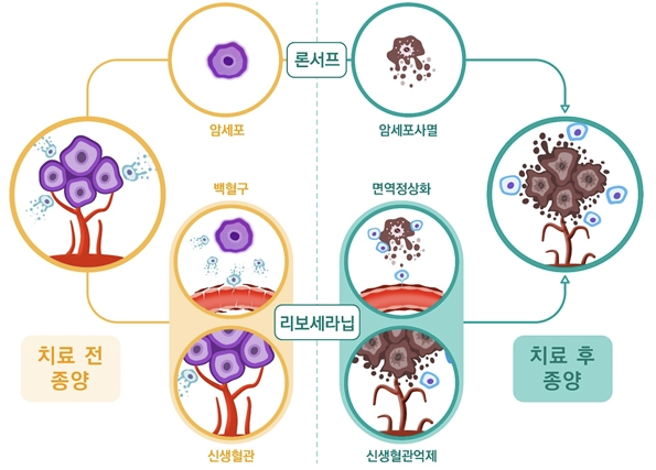 간암 신약 리보세라닙 승인