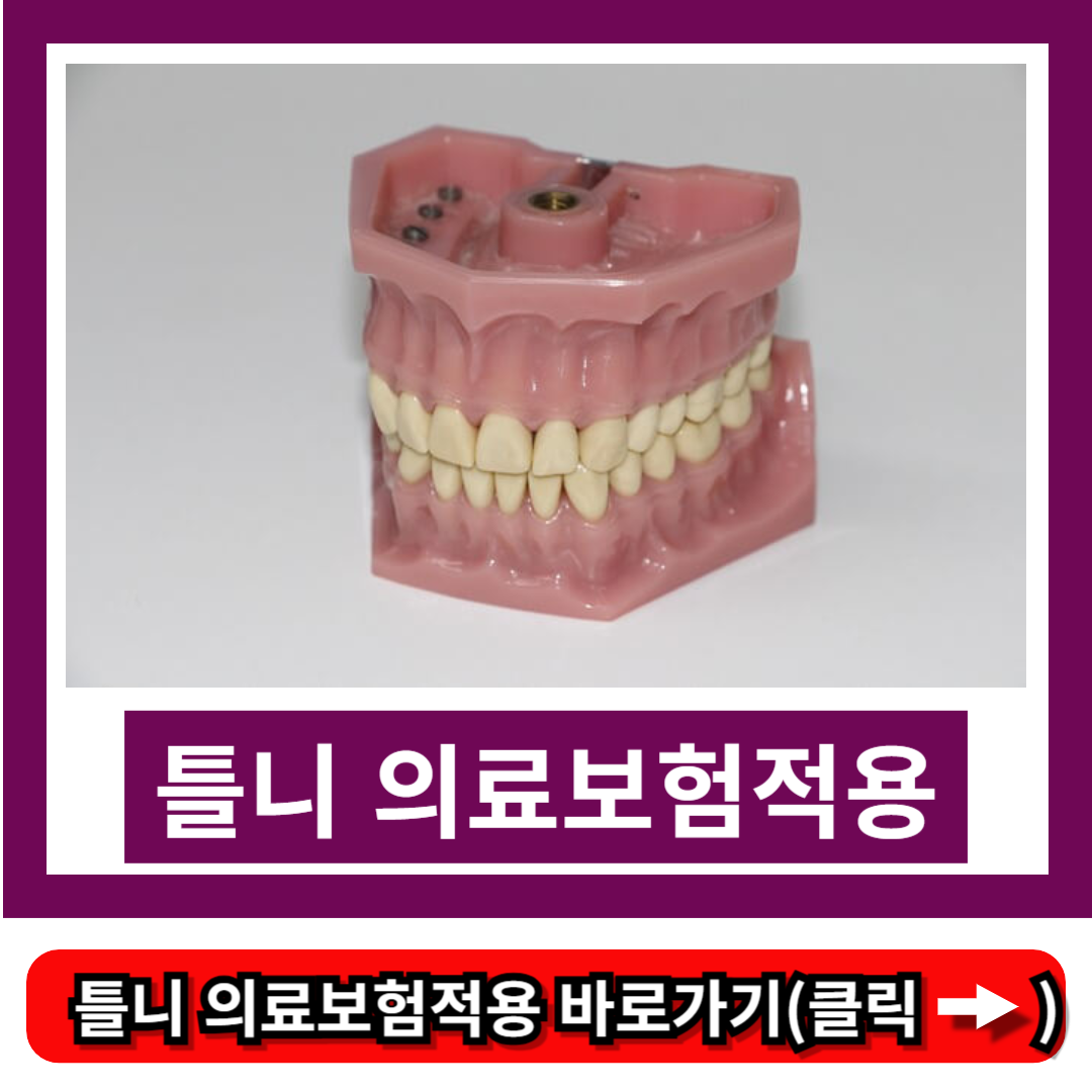 틀니 의료보험적용