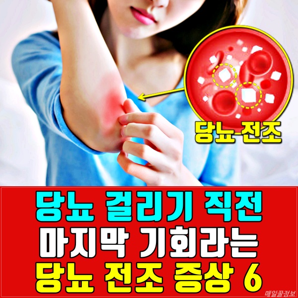 당뇨 전조 증상,당뇨 전단계 증상,혈당