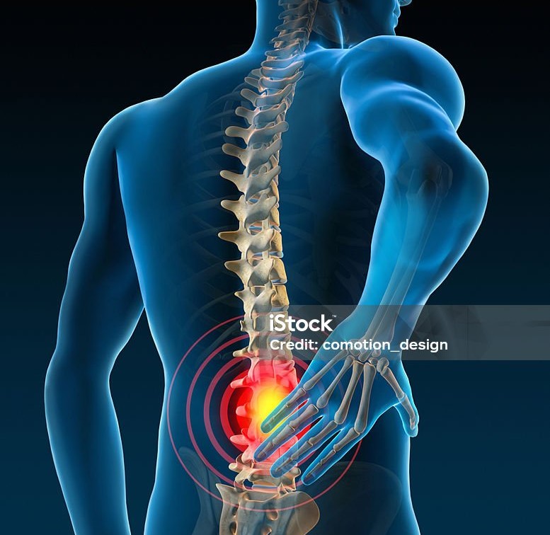 허리디스크증상