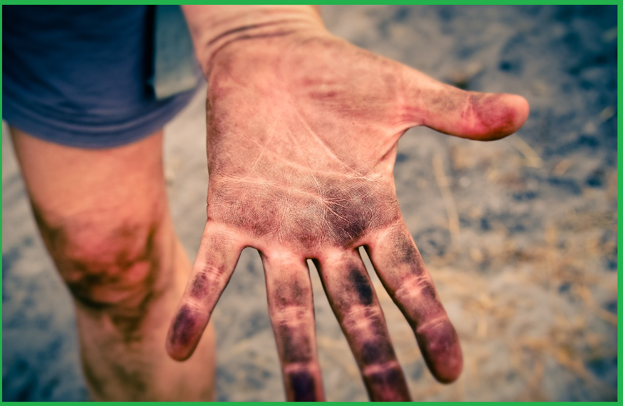 손가락 마디 통증 예방 방법 