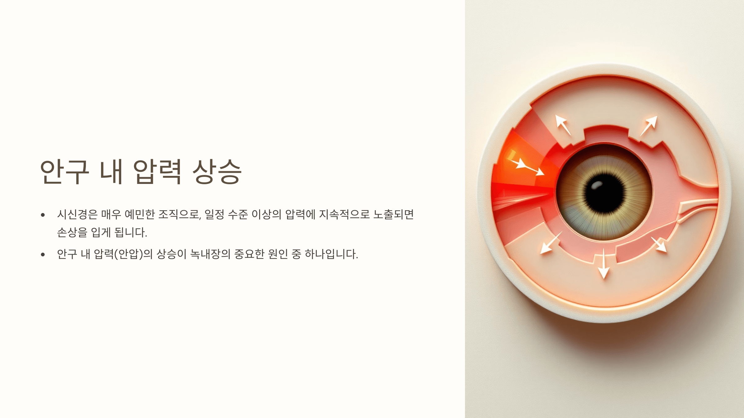 녹내장과 관련된 사진입니다.