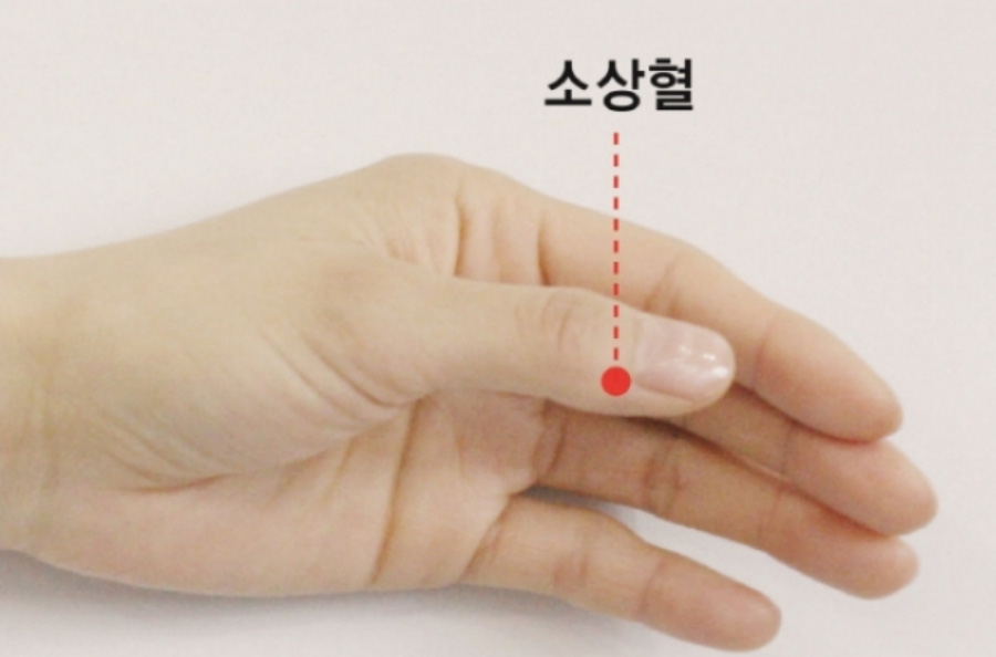 인체의 365혈 중에서 엄지손가락 손톱 안쪽에 쏙 들어가는 부분에 위치를 한 소상혈을 표시를 한 사진