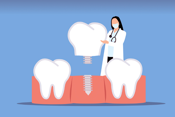 상악동 거상술 역할과 주의사항