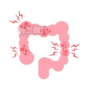 철결핍성 빈혈 원인 증상