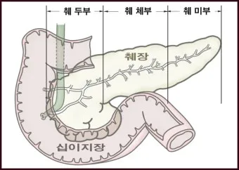강아지 췌장암 증상 진단 치료법 안내_23