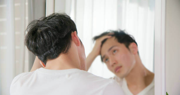 미녹시딜 여자 남자 효능, 탈모치료제 미녹시딜은 지난 몇년간 대세가 되어 온 탈모치료제 중 하나입니다. 미녹시딜은 남성형 탈모와 여성형 탈모 모두에게 효과가 있으며, 외용제 형태로 발매되고 있습니다. 이 글에서는 미녹시딜의 작용 메커니즘, 사용법, 주의사항 등을 자세하게 알아보도록 합니다.