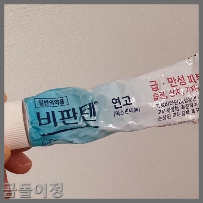 성인 엉덩이 두드러기 땀띠 뾰루지, 병원 안 가고 해결한 방법