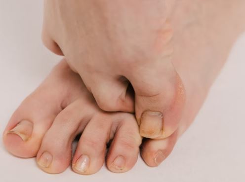 treatment-for-athlete-foot-by-symptom