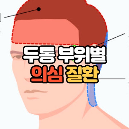 두통 부위별 의심 질환