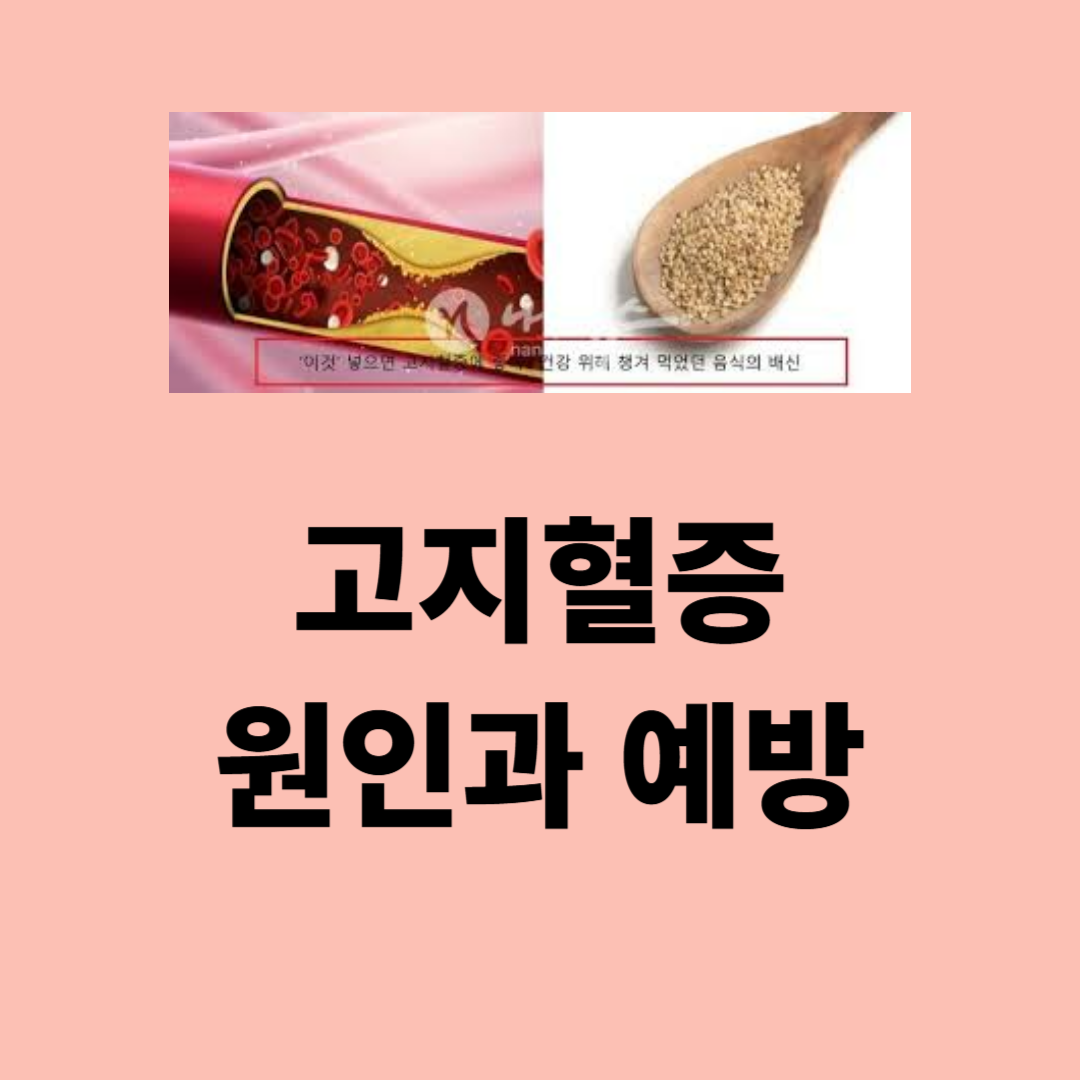 고지혈증의 원인과 예방을 위한 생활습관