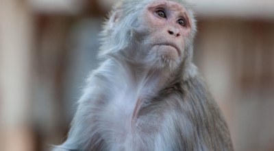 원숭이두창 이미지