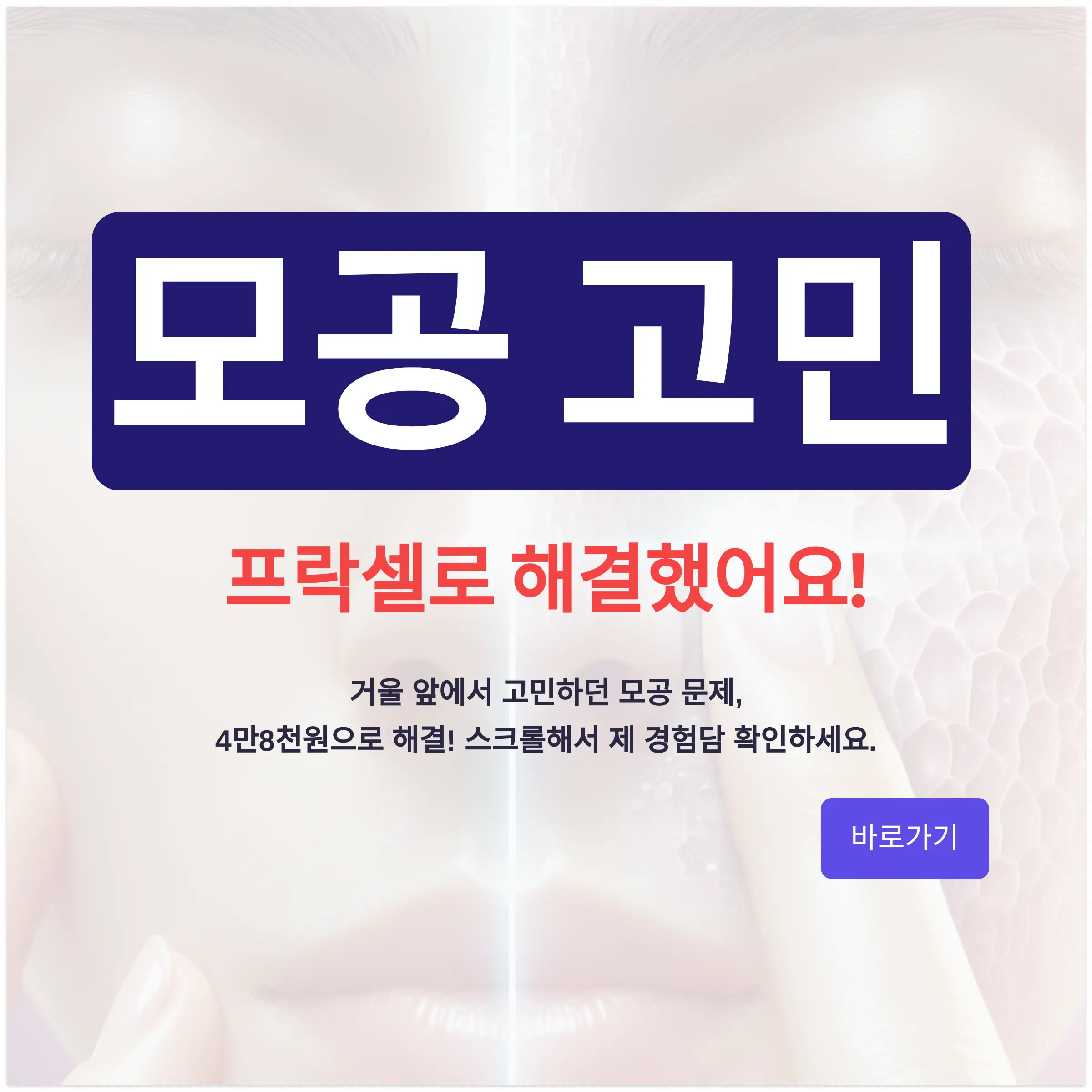 프락셀 레이저 후기