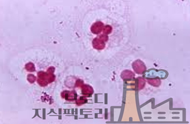 요도 간지러움