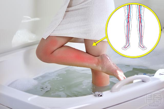 샤워 어지러움 히트쇼크 증상 예방 기립성저혈압