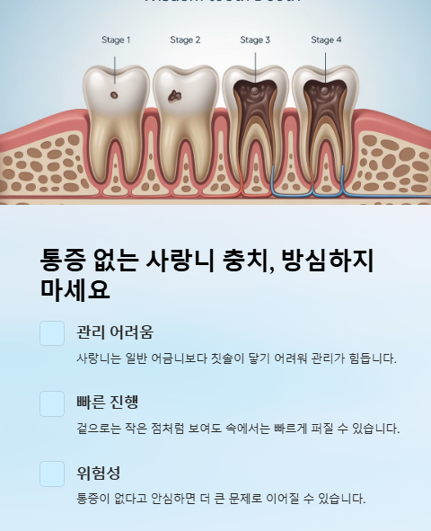 통증 없는 사랑니 충치 방심하지 마세요