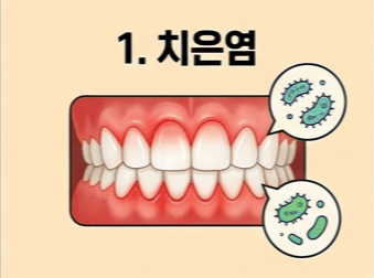 잇몸에서 피가 나는 이유