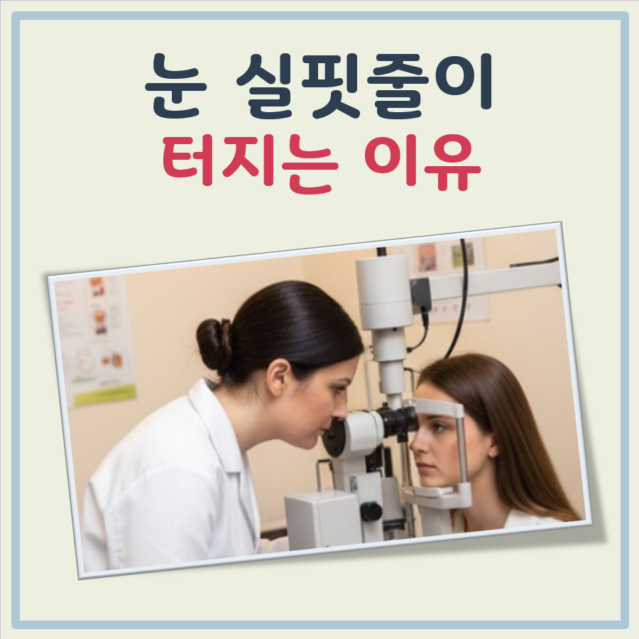 눈 실핏줄이 터지는 이유 대표 이미지