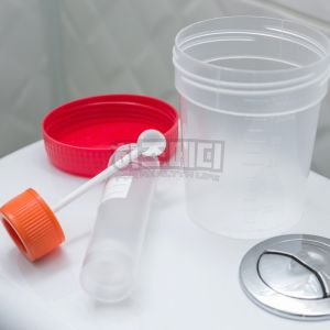 분변검사 방법