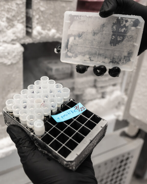 캘리포니아 연구소의 원숭이 수두 샘플