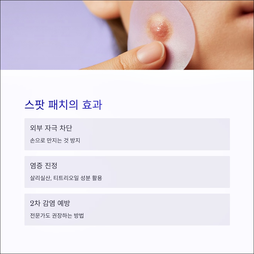 여드름 하루만에 없애는 패치