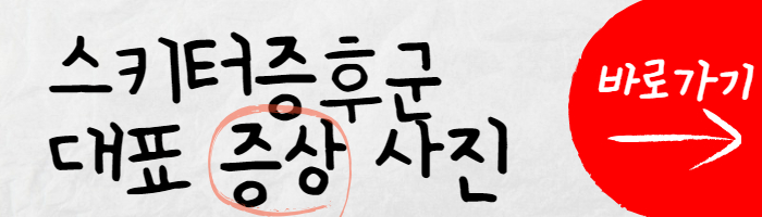 스키터증후군 증상