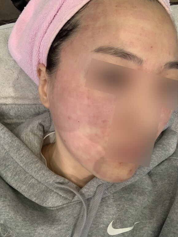 크라이오셀 후기