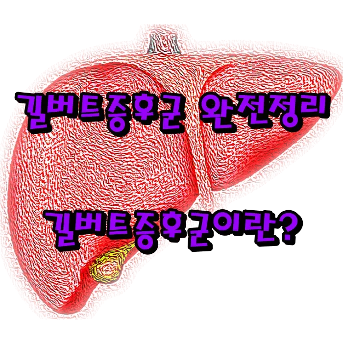 길버트증후군 완전정리|증상·치료법·군대·유전·좋은 음식까지 한눈에