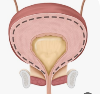 야간뇨빈뇨절박뇨-사진7