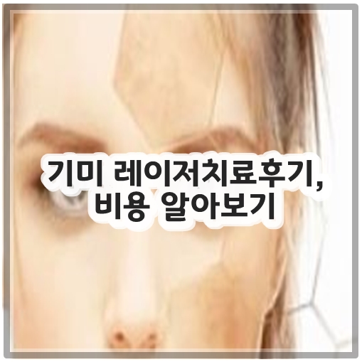 기미 레이저치료후기, 비용 알아보기